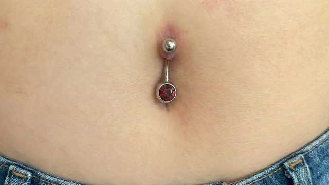  Köldök piercing kilökődése (migration), vékonyodó bőrrel